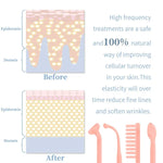 4 In 1 Vibrance High Frequency Wand