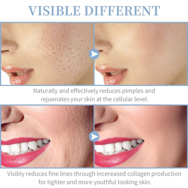 4 In 1 Vibrance High Frequency Wand