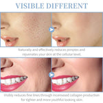 4 In 1 Vibrance High Frequency Wand