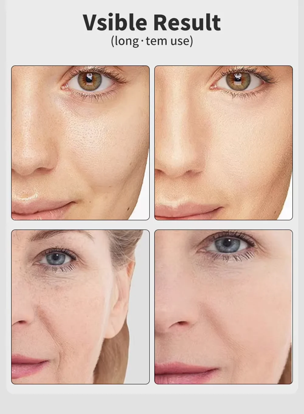 7-Color Facial Massager – EMS Lift & Anti-Wrinkle Device