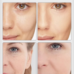 7-Color Facial Massager – EMS Lift & Anti-Wrinkle Device